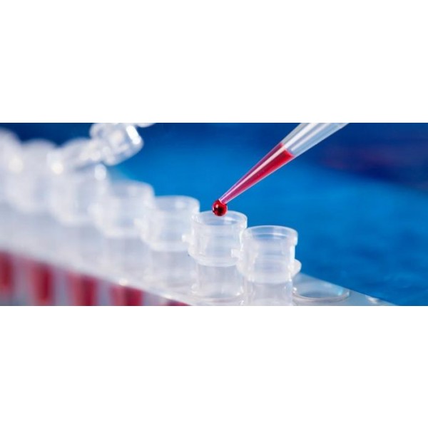 NucleoGene Molecular Detection Assay (Isothermal Amplification Technology)