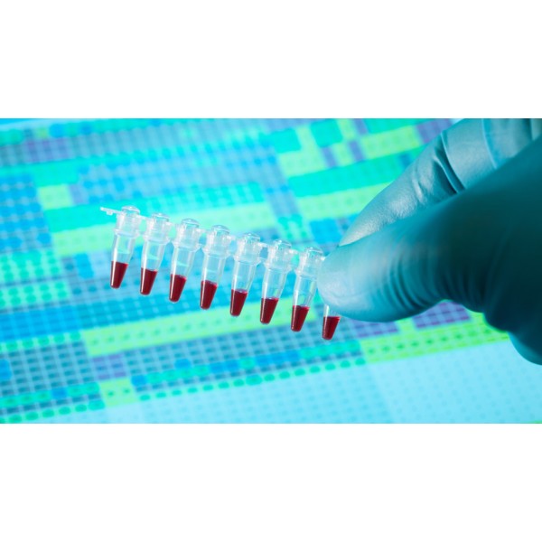 NucleoGene RNA to cDNA Mix (cDNA Synthesis Kit) (5X)