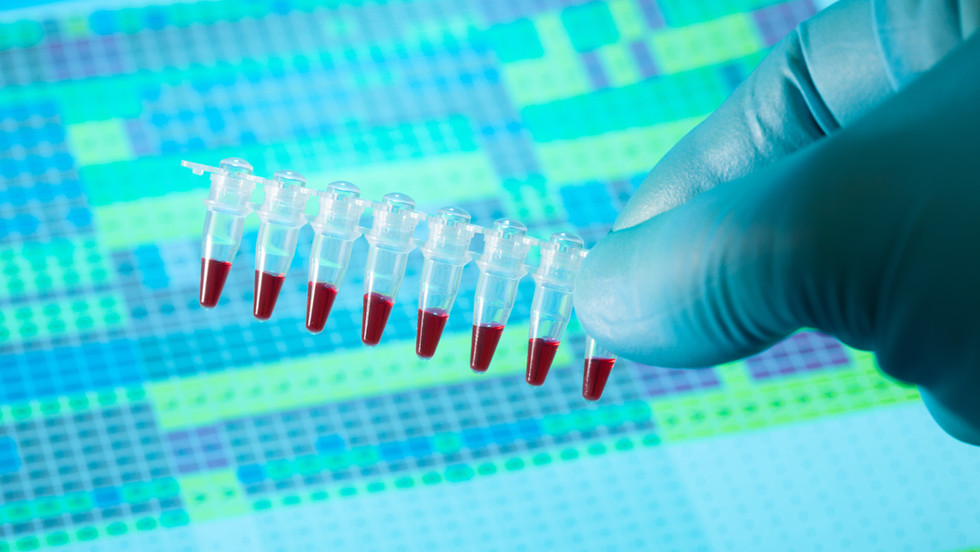 NucleoGene RNA to cDNA Mix (cDNA Synthesis Kit) (5X) 1